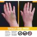 Dr. Robaina Arnica Bruise Gel - Fast Relief for Bruises & Swelling | Natural Ingredients | 12 oz - Buy Internationally - Buy Online on GoSupps.com