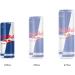 Red Bull Energy Drink 250ml (12 Pack) 250ml (Pack of 12) - Buy Online on GoSupps.com