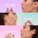 ZitSticka Blur Potion: Vitamin Supplement for Hyperpigmentation, Melasma & Dark Spots - 30 Caps - Buy Online on GoSupps.com