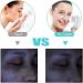 TOUCHBeauty Face Cleansing Brush with 3 Spin Brushes - Gentle, Deep Cleansing and Exfoliating with Case - Buy Online on GoSupps.com