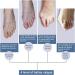 LTLCLZ Inflatable Bunion Corrector Splint - 1 Pair for Hallux Valgus, Hammer Toes, Pain Relief | Toe Straightener Separators for Foot Care - Buy Online on GoSupps.com