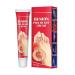 Bunion Pain Relief Cream Bunion Relief Cream Bunion Soothing Cream Bow Bunion Relief Creme for relieving articulated toe pain in the event of stiffness and inflammation 20g