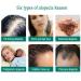 Hair Growth Serum - Thicker Longer Fuller Hair | Prevent Hair Loss & Thinning | Vitamin-Rich Natural Treatment - Shop Now - Buy Online on GoSupps.com