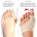 CRLLDPM Hallux Valgus Correction - Bunion Corrector & Toe Splitter - 1 Pair with Silicone Wager for Effective Relief - Buy Online on GoSupps.com