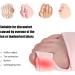 Bunion Toe Separator & Hallux Valgus Corrector for Women - Pain Relief & Daytime Support - 2 Pieces - Buy Online on GoSupps.com