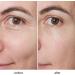 Eye Massager with Heat for Dark Circles & Dry Eyes - 6 Modes & 3 Levels | Anti-Aging Eye Care Device - Buy Online on GoSupps.com