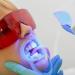 Buy Cheek Retractor Mouth Opener - C-Shape Dental Tool for Teeth Whitening & Party Games - 10 Blue Pieces | International Shipping Available - Buy Online on GoSupps.com