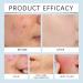 Hyaluronic Acid Microneedling Serum Hyaluronic Acid Serum Gla-Mory Micro-Infusion Facial System Hyaluronic Acid Micro Needling Roller Hyaluronic Acid Face Serum for Women Hydrating Anti Wrinkle - Buy Online on GoSupps.com