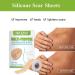 Silicone Scar Sheets 1.6 x 60 - Keloid & Burn Scar Removal Tape - Buy Online on GoSupps.com