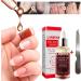 Beito 1PC Nail Repairs Solution de renouvellement des ongles l'huile essentielle tue les ongles fongiques Traitement fongique pour ongles cassants et craquel s (12ML) - Buy Online on GoSupps.com