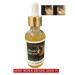 Miracle Stretched Earlobe Corrector Oil - Fix Torn & Stretched Piercing Holes - Buy Online on GoSupps.com