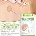 Silicone Scar Gel Strip - Efficient Scar Treatment for Surgery, Acne & Trauma - 4 * 150cm - Buy Online on GoSupps.com