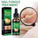  Cymwer Ginger Nail Serum 30ml Natural Growth Oil Strengthener for Fortified Nails Moisturizing and Revitalizing Care - Buy Online on GoSupps.com