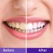 Nolipem Purple Toothpaste for Teeth Whitening | Effective Stain Removal & Teeth Brightening - Buy Online on GoSupps.com