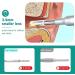 EYEARN Visual Ear Wax Removal Tool with 5-inch Screen | Portable Ear Cleaner Kit with Inspection Camera for Easy Cleaning - Buy Online on GoSupps.com