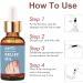 Ingrown Toenail Treatment 30ml Ingrowing Toenail Treatment Toenail Anti Paronychia Relief Oil Correction Ingrown Toenail Softening Drops for Damaged Discolored Thick Nail - Buy Online on GoSupps.com