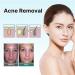Goopgen Advanced Scar Repair Serum - Scar Removal Ampoule Spray (1pcs) - For All Types of Scars - Buy Online on GoSupps.com