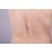 LURE Essentials Fade Stretch Marks Cream with Cocoa Butter - Pregnancy Stretch Mark Remover & Prevention - Buy Online on GoSupps.com