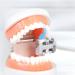 U Shadow Toothbrush for Sensitive Teeth & Gums | Soft Bristle Micro Toothbrush for Adults - Gray | Optimal Oral Care - Buy Online on GoSupps.com