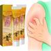 pohdhk Youth Bee Venom Anti-Itch Treatment Cream - Bee Venom Psoriasis Treatment Cream New Zealand Bee Venom Professional Psoriasis Treatment Cream Psoriasis Treatment for Skin (2Pcs)
