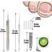 (12 +3) Ingrown Toenail Correction Treatment Kit Ingrown Toenail Correction Strips Brace Kit Ingrown Toenail File and Lifter Ingrown Toenail Corrector Straightener Strips for Nail Foot Care - Buy Online on GoSupps.com