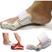 GOMYIE Adjustable Bunion Corrector for Hallux Valgus Relief | Soothes Sore Bunions and Foot Pain - Buy Online on GoSupps.com