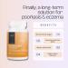 CoLymph Psoriasis & Eczema Relief - Vegan Formula for Rash Rosacea & Flare-ups - Supports Immune Health Made in USA - Buy Online on GoSupps.com