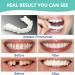 Fluktrix Clip-in Veneers for Artificial Teeth - Temporary Cosmetic Solutions for a Confident Smile - Buy Online on GoSupps.com