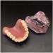 Vinbcorw Dental Model - Maxilla Mini 4 Implant Screws for Mobile Prosthesis Repairs | Removable Pink Design - Buy Online on GoSupps.com