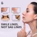 myolift Jowl Mask | Microcurrent Technology for a Perfect Jawline | Fight Aging & Wrinkles | Easy to Use & Reusable | Visible Results for Flawless Skin - Shop Internationally - Buy Online on GoSupps.com