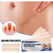 4Pcs Silicone Scar Repair Patch - Lighten Pigmentation, Odorless, Effective Skin Repair - Color S - Buy Online on GoSupps.com