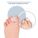 Relax Tony Toe Separators 8Pcs Individual - White | Foot Pain Relief - Buy Online on GoSupps.com
