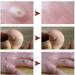 15ml Corn and Wart Remover Liquid for Feet - Callus and Cuticle Removal Treatment - Buy Online on GoSupps.com