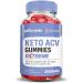 2 Pack Microbio Keto ACV Gummies 2000MG - Vegan Non-GMO Apple Cider Vinegar with Pomegranate & Beet Juice - 120 Gummies for Keto & Weight Loss - Buy Online on GoSupps.com