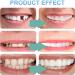 Shop High-Quality Fake Teeth & Temporary Dentures for Men & Women - 4 Pairs of Comfortable False Teeth - Buy Online on GoSupps.com