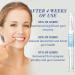Buy Gums Therapy Gel & Teeth Whitening Pens - Deep Cleaning Stain Removal for Sensitive Teeth (2pcs) | Brighten Your Smile Today! - Buy Online on GoSupps.com