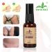 Natural Eczema & Urticaria Treatment Diaper Rash Cream for Babies - Mingmei Herbal Formula 1.5oz - Buy Online on GoSupps.com
