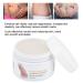 Stretch Stripes Cream 120g | Remove Stretch Marks Pregnancy Scars & Acne | Maternity Repair Treatment - Buy Online on GoSupps.com