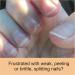 Penetrating Fingernail Conditioner & Strengthener | Repair Weak Peeling & Brittle Nails - 1 Bottle - International Shipping - Buy Online on GoSupps.com