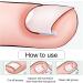 Corrective for Ingrown Nails Correction of Ingrown Nails Correction Kit 30 Pieces Correction Strips for Ingrown Nails Toe Nail Correction - Buy Online on GoSupps.com