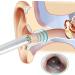 XIXIDIAN Ear Wax Removal Tool Wireless Ear Endoscope Cleaner with Camera 5.5 mm Otoscope Ear Cleaner with LED Lights for Adults Kids - Buy Online on GoSupps.com
