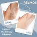 RELMOS Professional Paper Wax Waxing Strips Legs Arms Body (1 Pack) 1 count (Pack of 1) - Buy Online on GoSupps.com