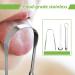 Stainless Steel Tongue Scraper - Effective Tongue Cleaner for Fresh Breath & Optimal Oral Hygiene - Improve Oral Health Worldwide - Buy Online on GoSupps.com