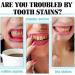 Scoban Whitening Toothpaste with Hyaluronic Acid & Baking Soda - Deep Cleaning Formula (2pcs) | International Shipping - Buy Online on GoSupps.com