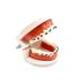 Dental Orthodontic Model with Metal Brackets and Arch Wire - Standard Teeth Model with Braces for Demonstration - Buy Online on GoSupps.com