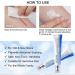 Harsha Tamoskiny Scar Removal Cream 30g - for Stretch Marks, Surgery, Injuries & Burns - All Skin Types - Buy Online on GoSupps.com
