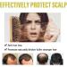 SHENGZE Identicalven Hair Loss ShampooGinger Plant Extract AntiHair Loss Hair ShampooAnti Hair Loss ShampooHair Growth Plant ShampooOil Control AntiDandruff Shampoo for Women Menfor All Hair Types - Buy Online on GoSupps.com
