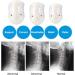 Naked Adjustable Neck Support - Prevent Cervical Spondylosis & Relieve Migraines | Wh M White | International Shipping - Buy Online on GoSupps.com