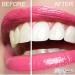 Lovely Smile Teeth Whitening Strips - 28 Express White Strips - Fast Results in 1 Hour - No Slip, No Sensitivity - Enamel Safe Dental Whitener Kit - Buy Online on GoSupps.com