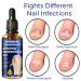 German ToenailPlus Anti Paronychia Relief Oil - Repair Damaged Nails (2 Pcs) - Buy Online on GoSupps.com